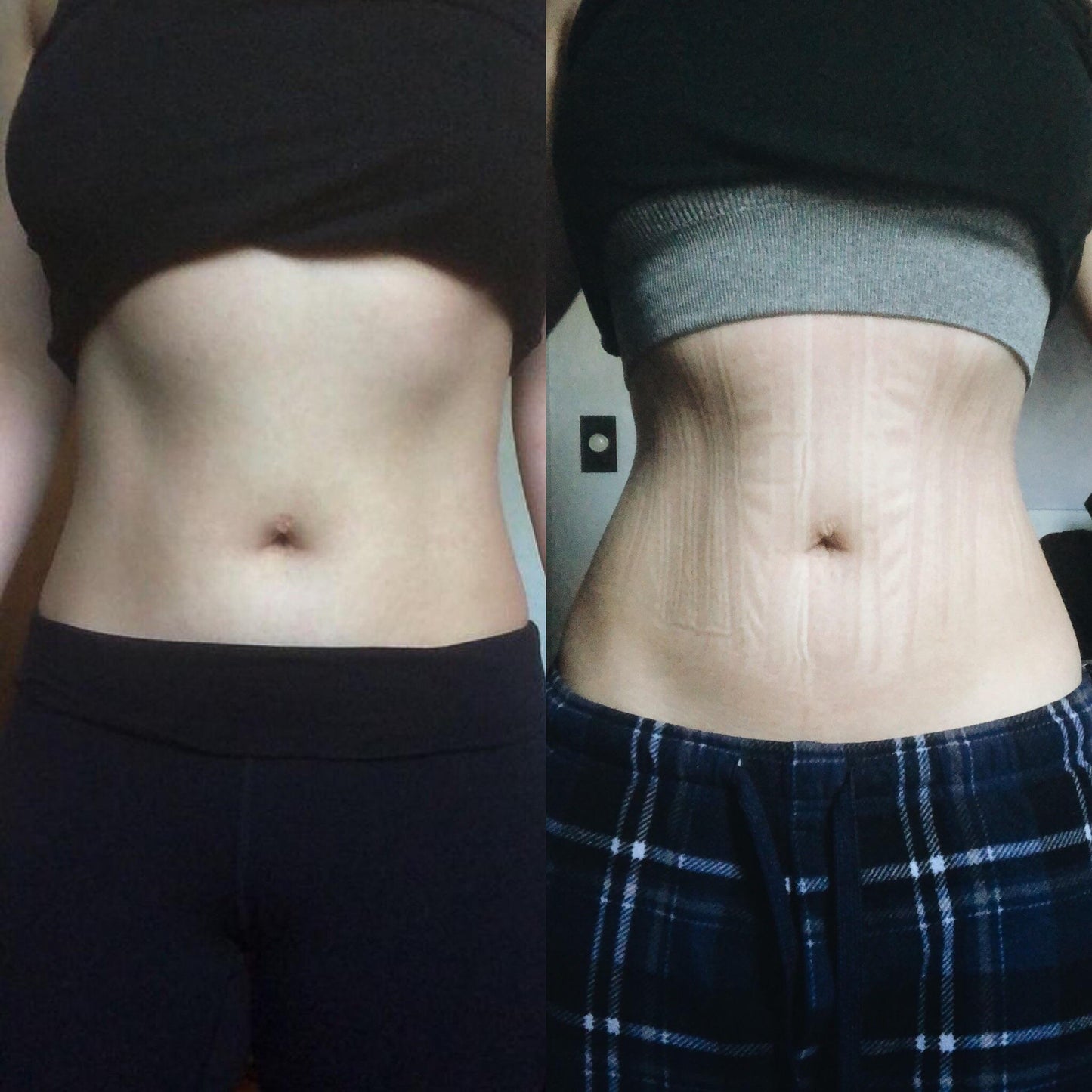 SculptWaist™ – Ceinture Gainante Ultra Définition